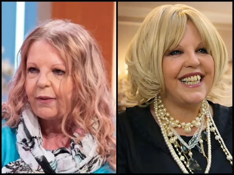 Sally Thomsett Face Illness